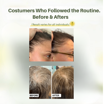 RootLogic™ Anti-Hair Fall Shampoo