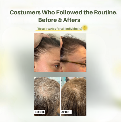 RootLogic™ Anti-Hair Fall Shampoo