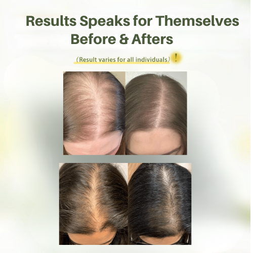 RootLogic™ Anti-Hair Fall Shampoo
